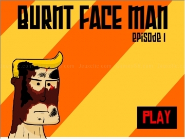 Burnt face man 1