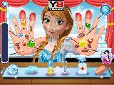 Play Anna hand doctor