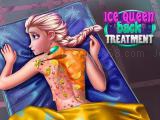 Play Ice queen back treatment now