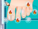 Play Blonde sofia: ingrown toenail now