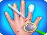 Play Fun baby care kids game - hand skin doctor