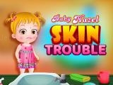 Play Baby hazel skin trouble now